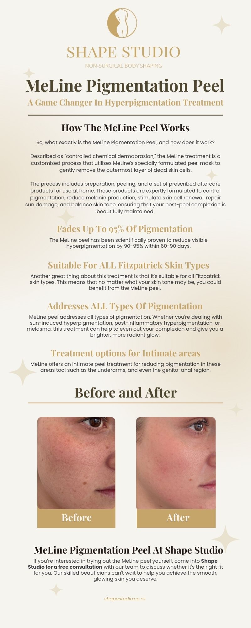 Shape Sudio MeLine Pigmentation Pell Services