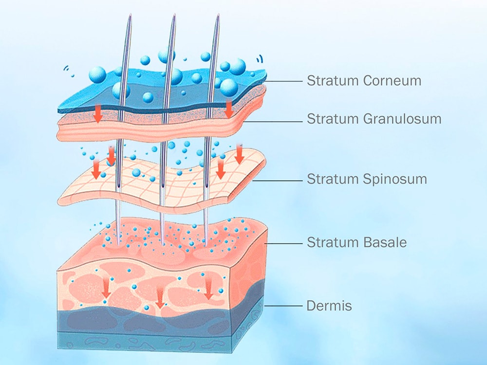 Shape Studio Latest Services SQT Bio Microneedling blog 3